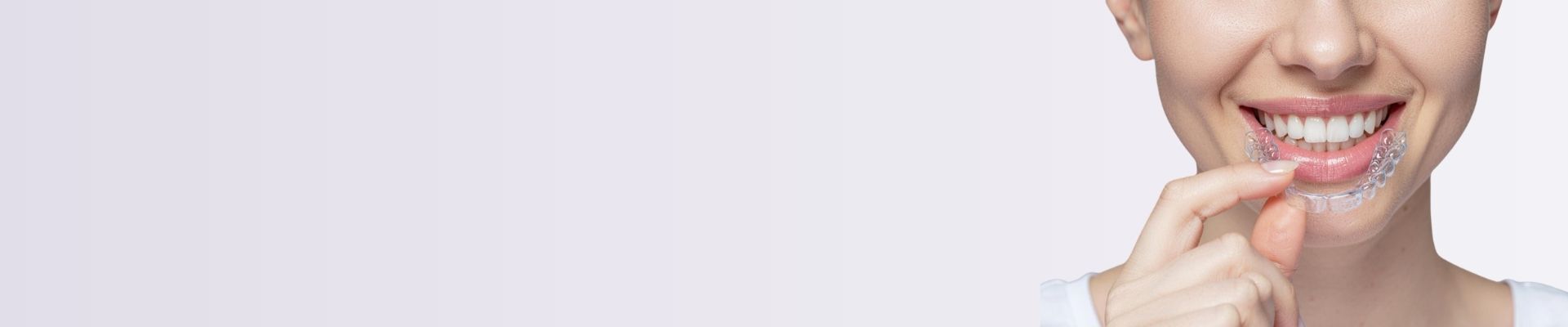 Invisalign Image